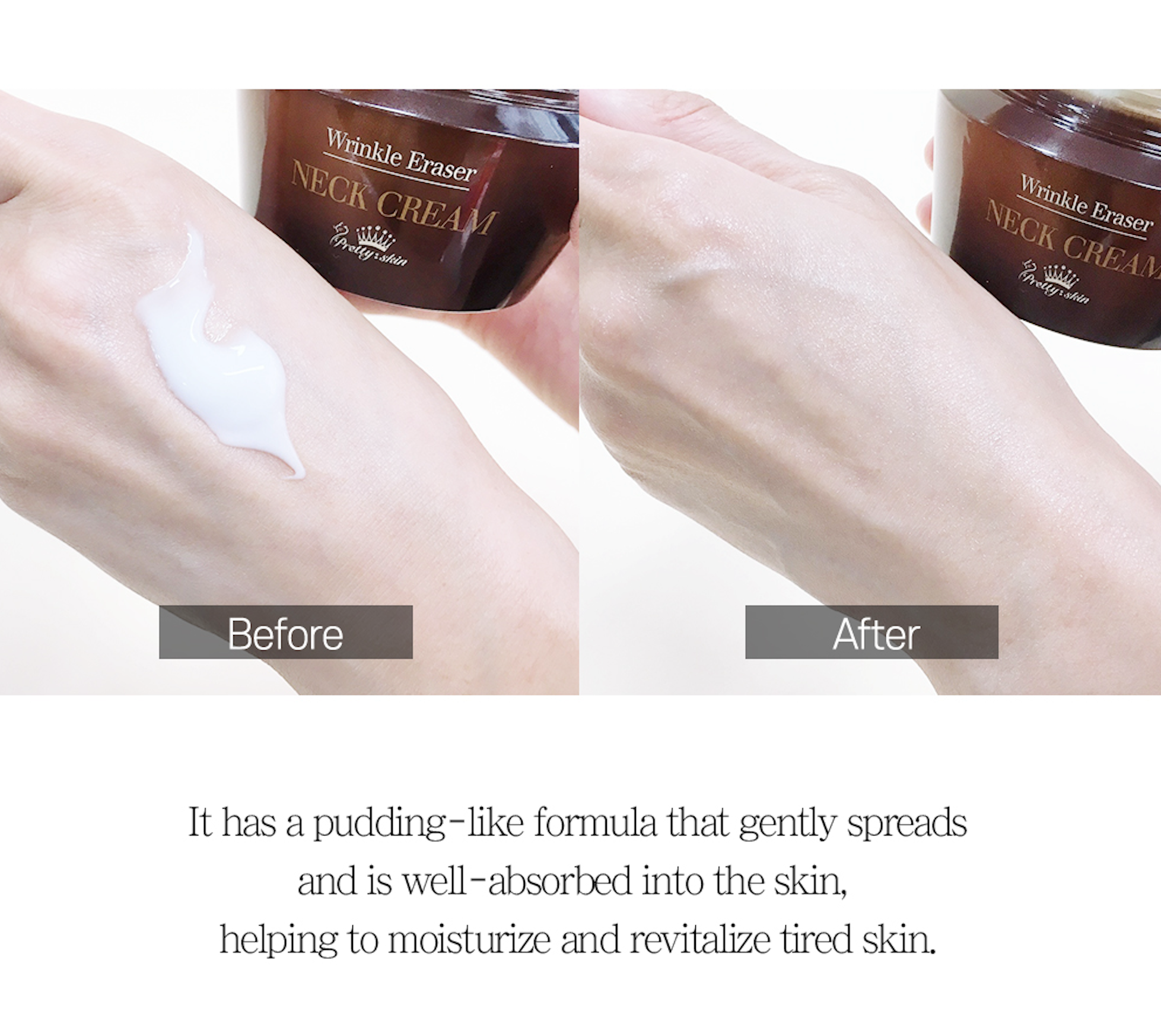 Crema de cuello-Wrinkle eraser