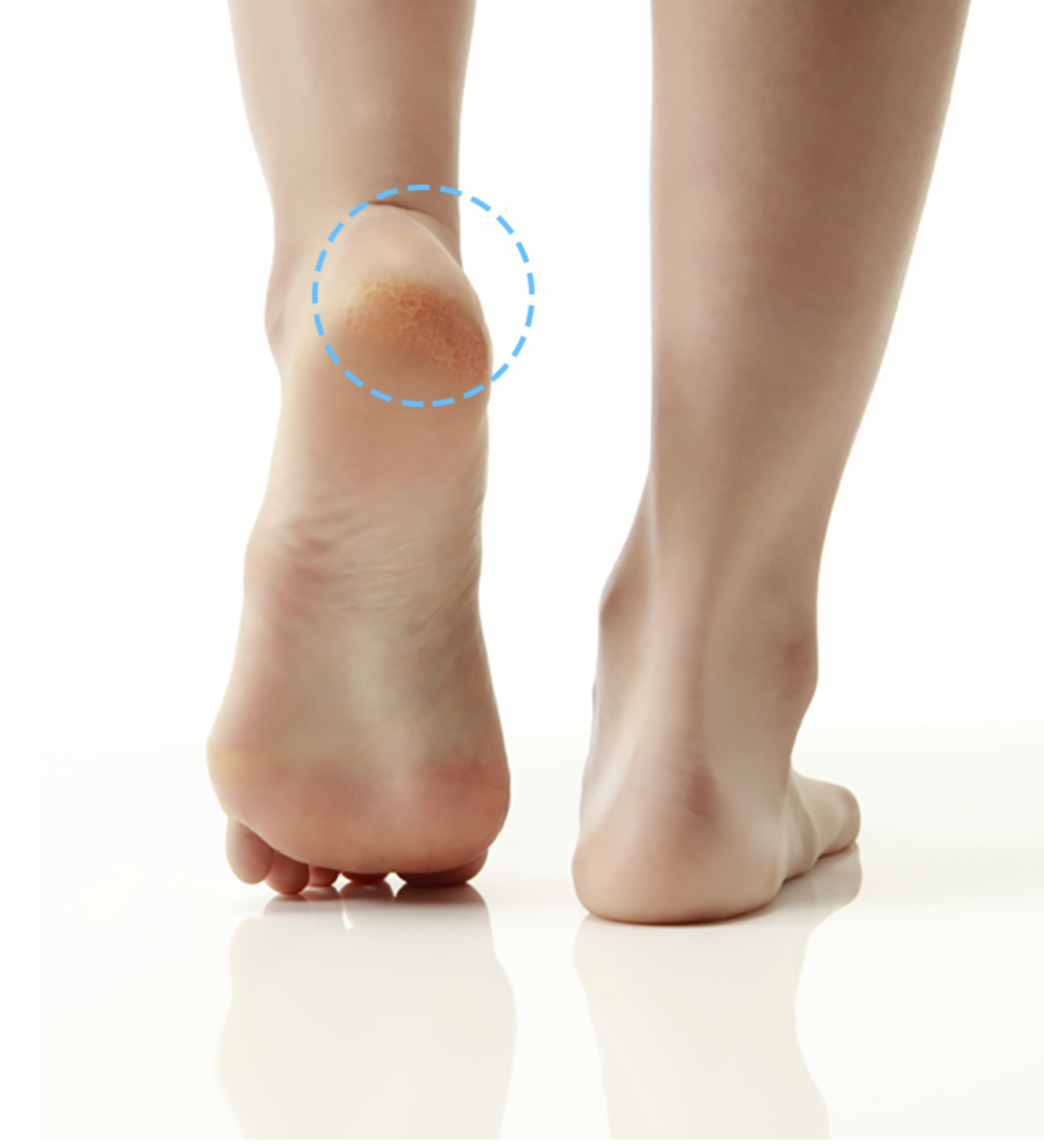Foot Peeling- Mascarilla exfoliante para pies.